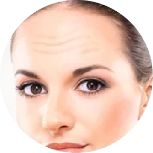 rejuvenescimento